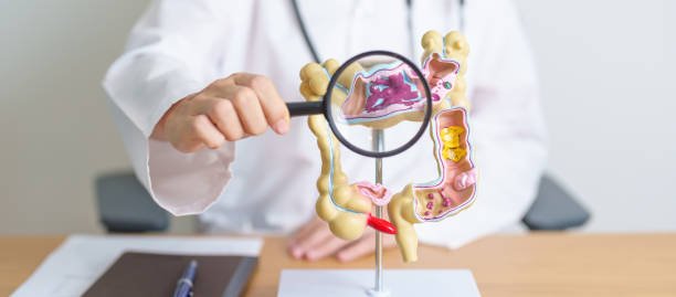 Are We Asking the Wrong Questions About Crohn's Disease?